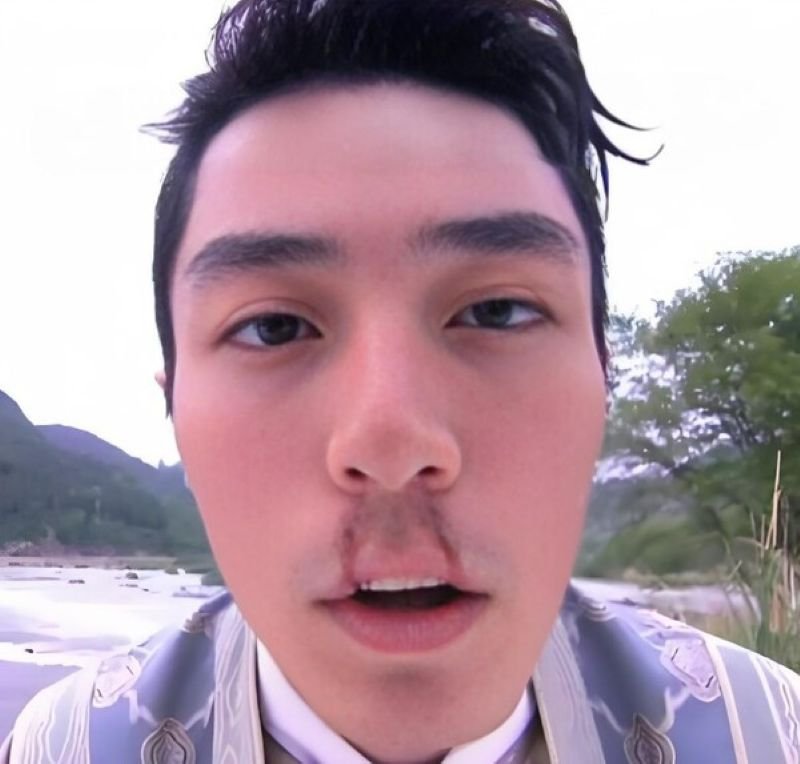 meme chảy máu mũi biểu cảm bá đạo